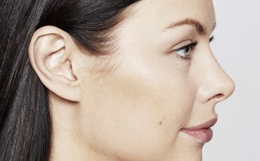 Restylane®Kysse™– en leppefiller som gir partneren lyst til å kysse deg mer